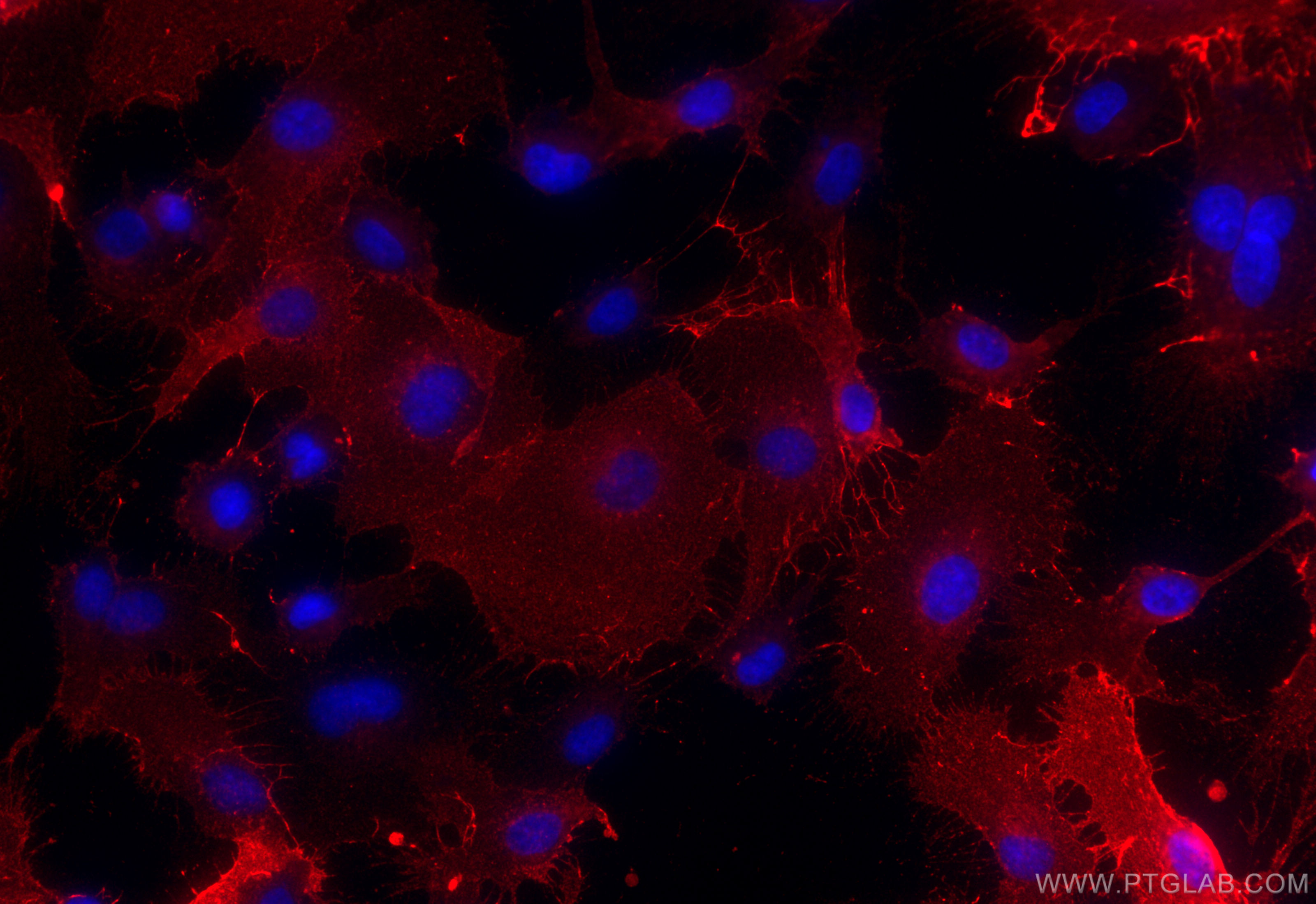 IF Staining of HUVEC using 31339-1-AP