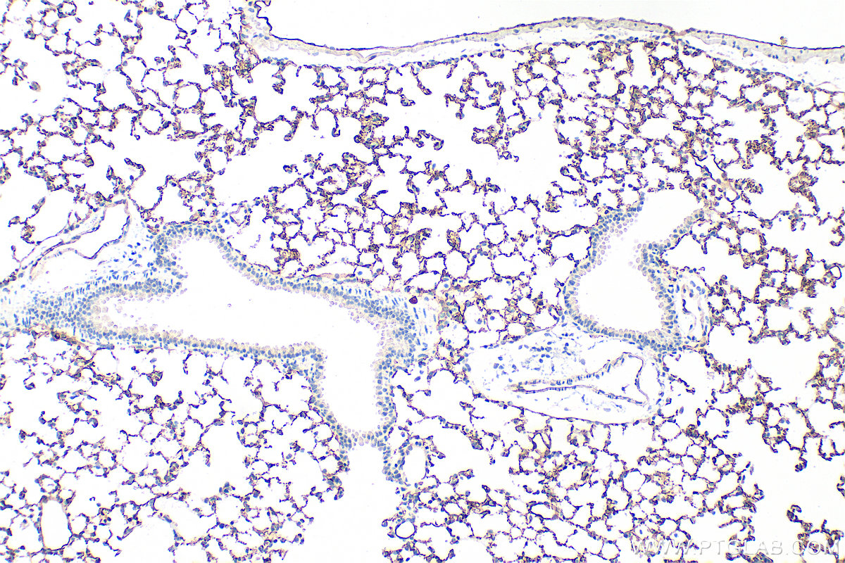 IHC staining of mouse lung using 31339-1-AP