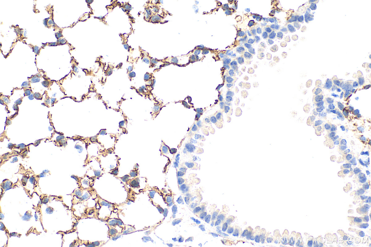 IHC staining of mouse lung using 31339-1-AP