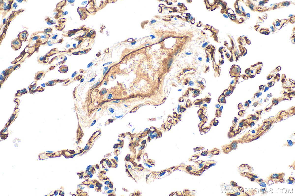 IHC staining of human lung using 31339-1-AP
