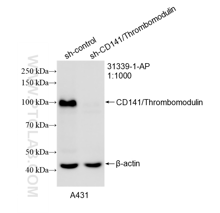 WB analysis of A431 using 31339-1-AP
