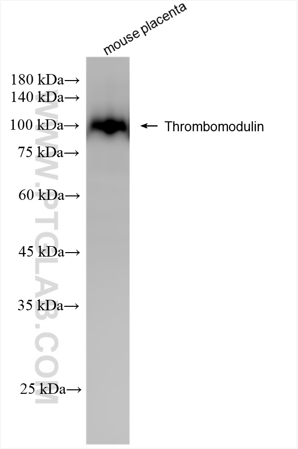 WB analysis of mouse placenta using 84412-3-RR