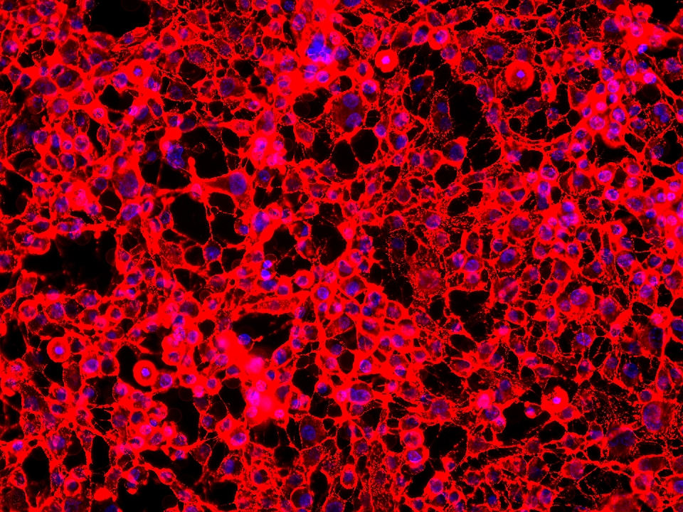 IF Staining of HUVEC using 65181-1-Ig