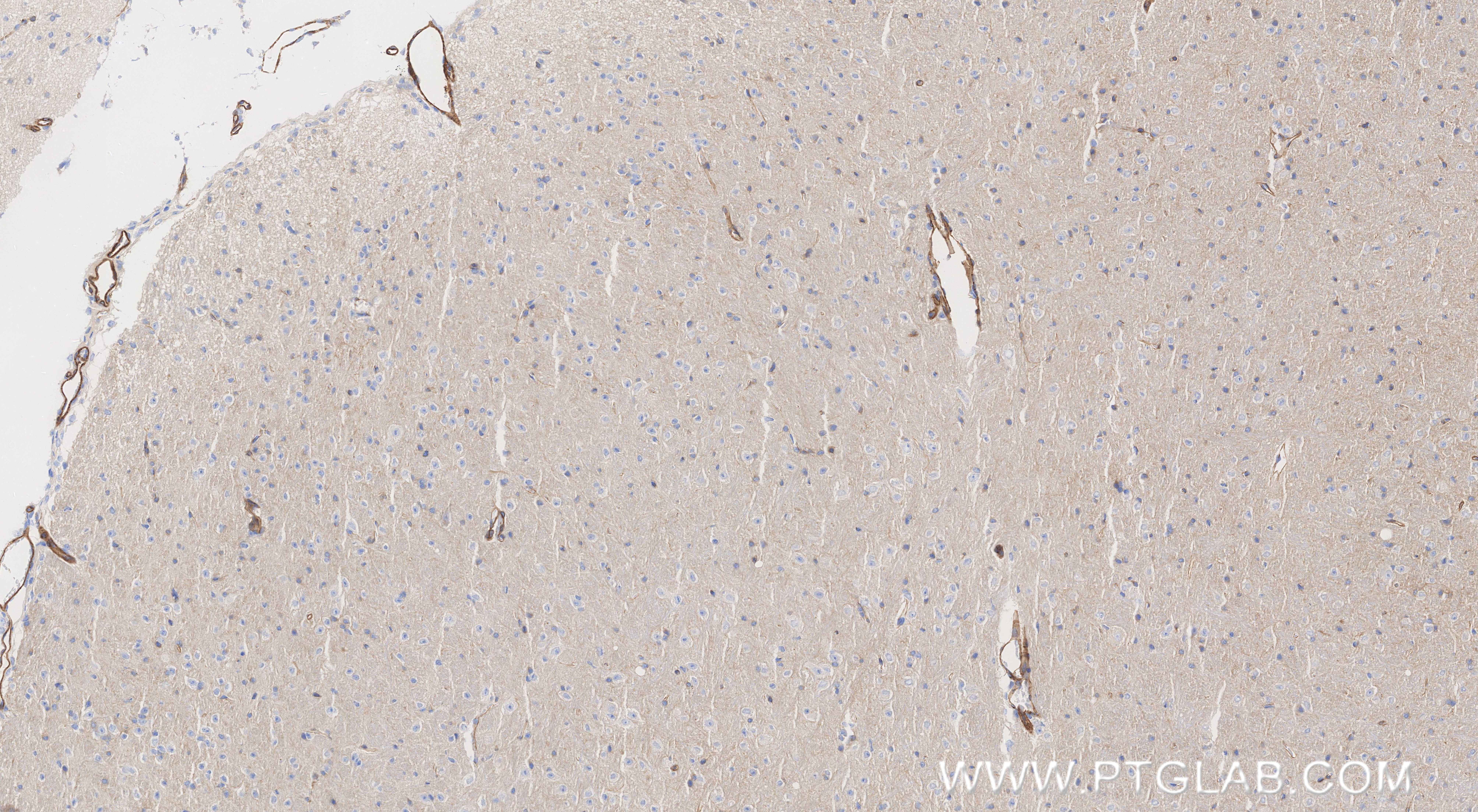 IHC staining of mouse brain using 86159-3-RR