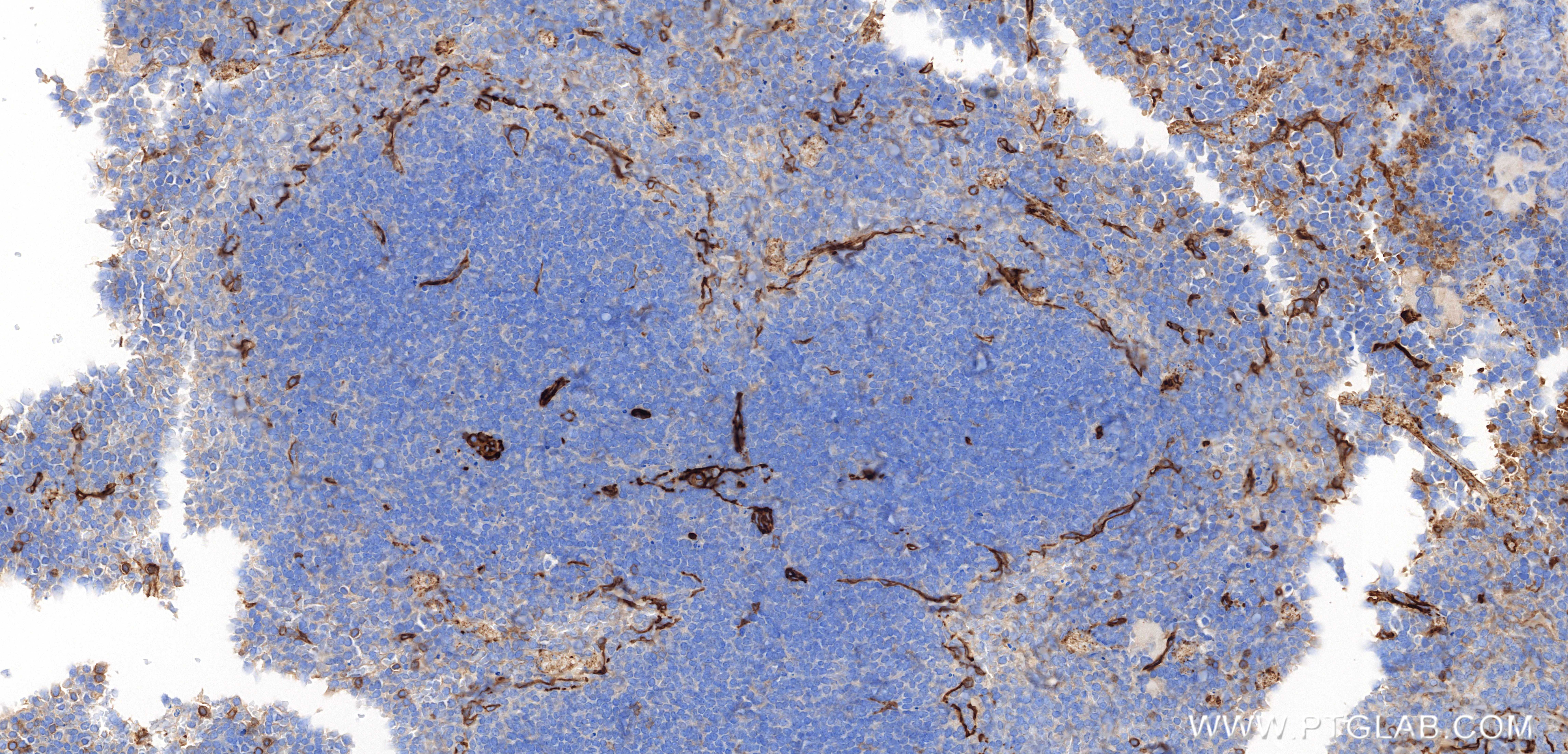 IHC staining of mouse spleen using 86159-3-RR