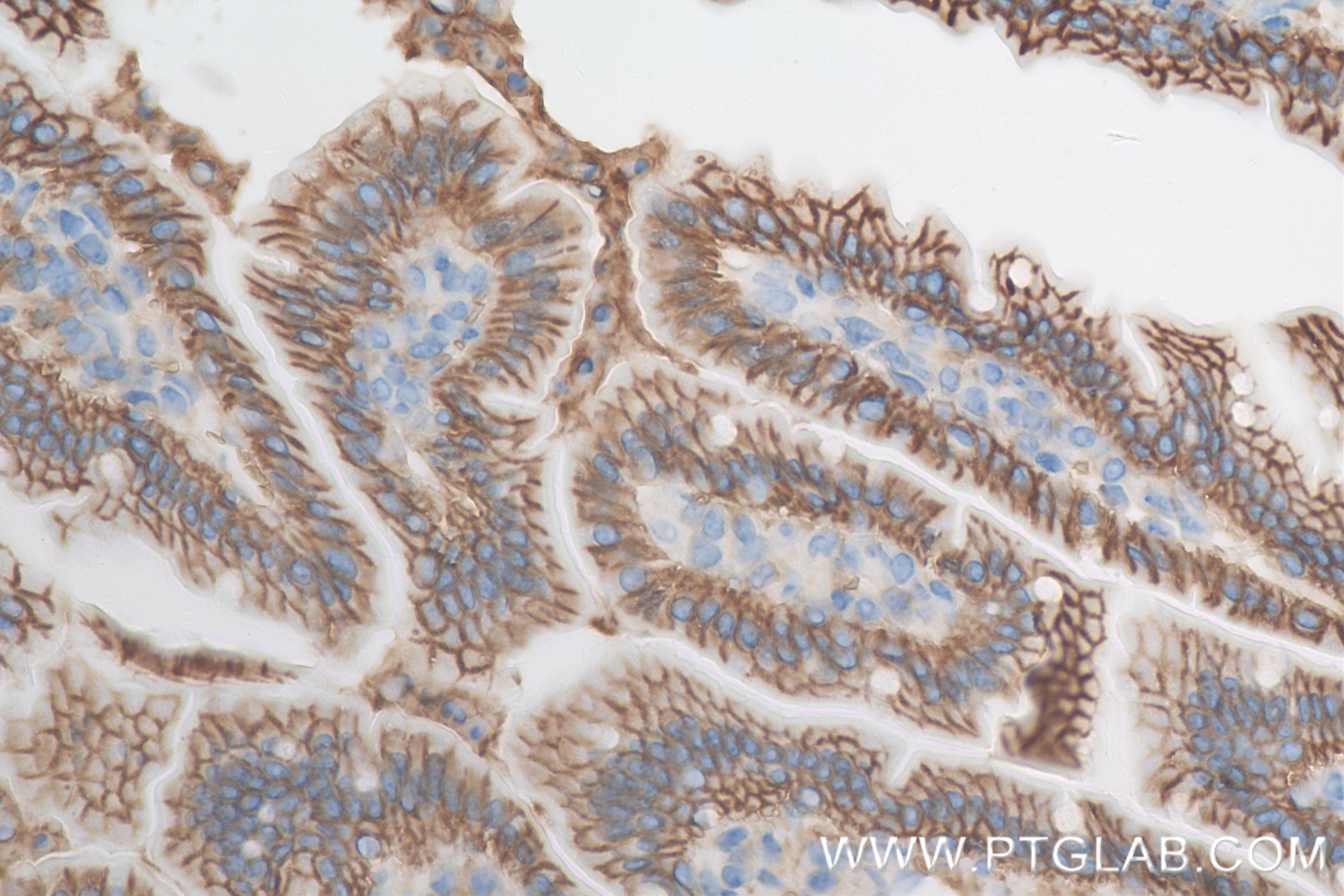 IHC staining of mouse small intestine using 84488-6-RR