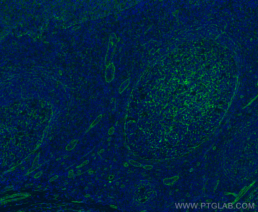 IF Staining of human tonsillitis using 66567-1-Ig (same clone as 66567-1-PBS)