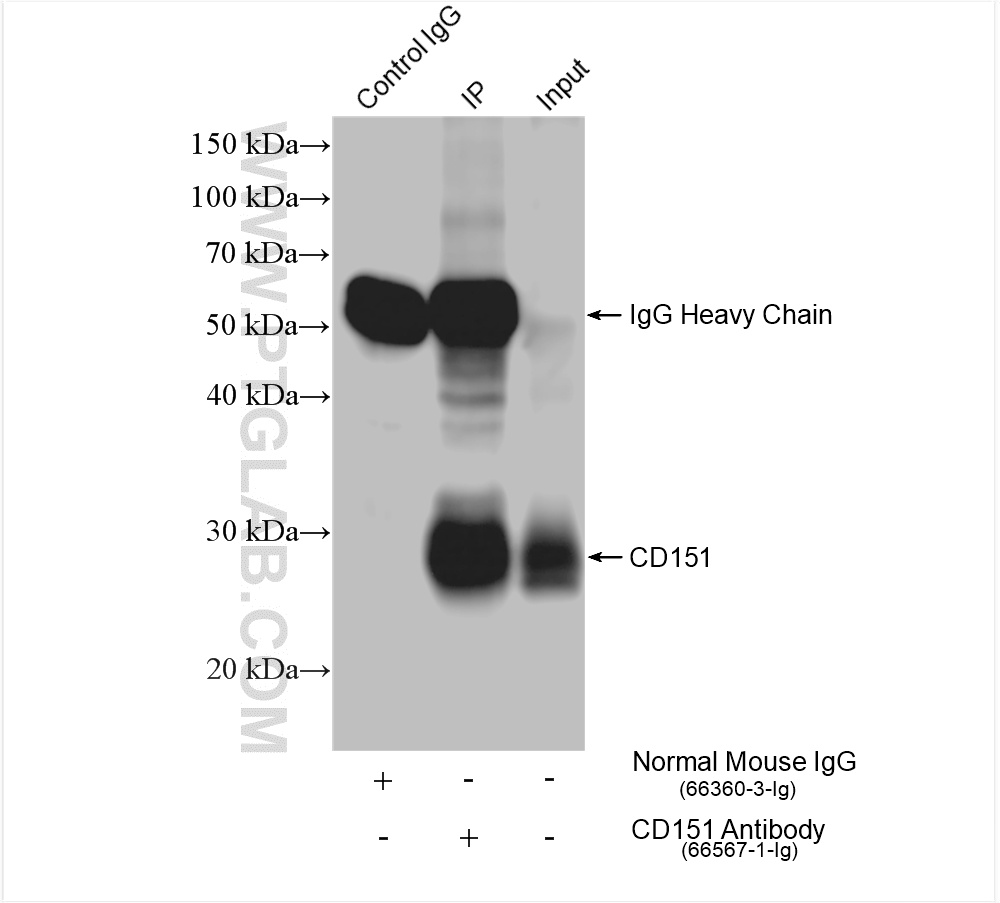 IP experiment of human placenta using 66567-1-Ig (same clone as 66567-1-PBS)