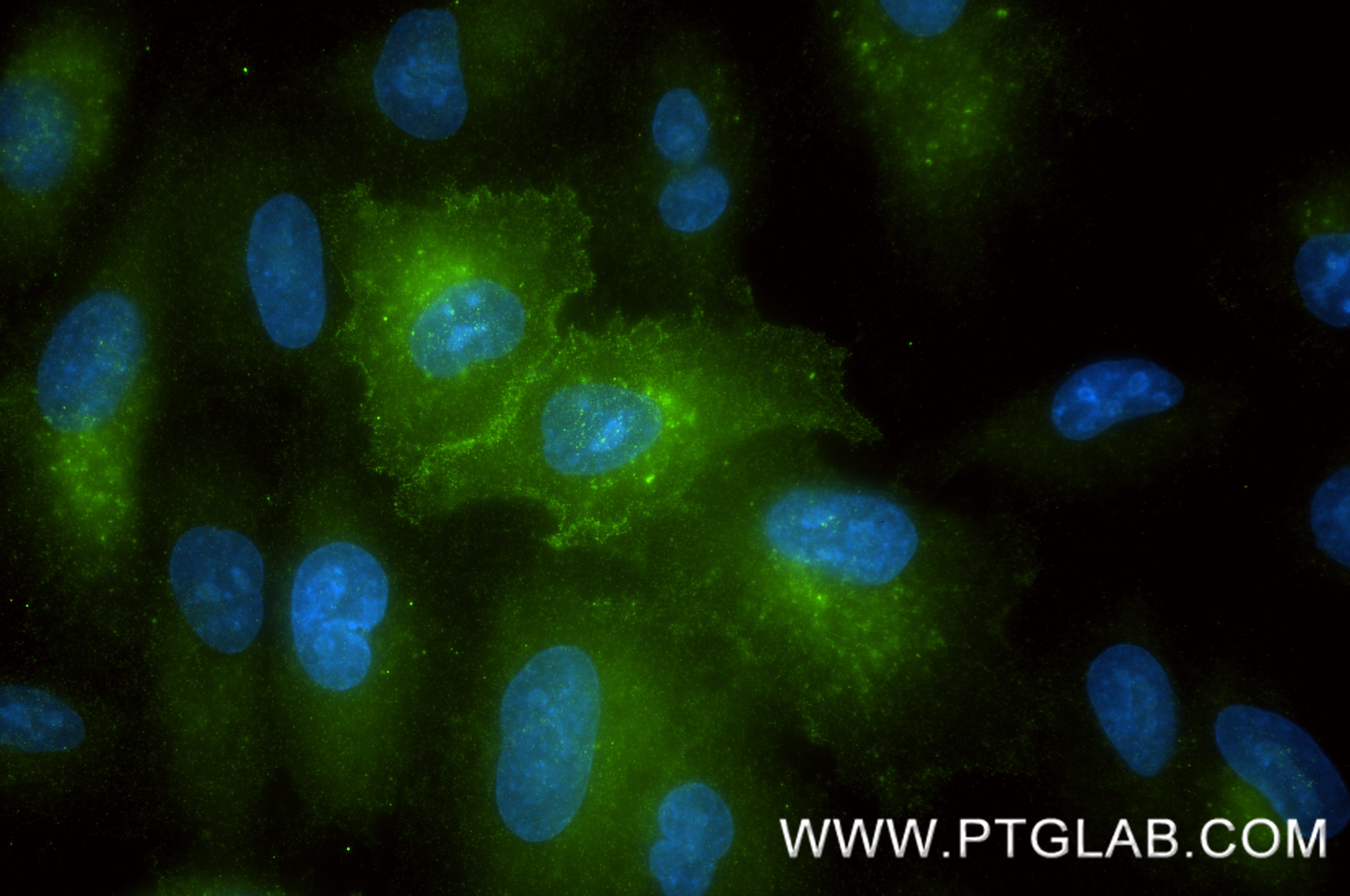 IF Staining of A549 using 85385-1-RR (same clone as 85385-1-PBS) IF Staining of A549 using 85385-1-RR (same clone as 85385-1-PBS)