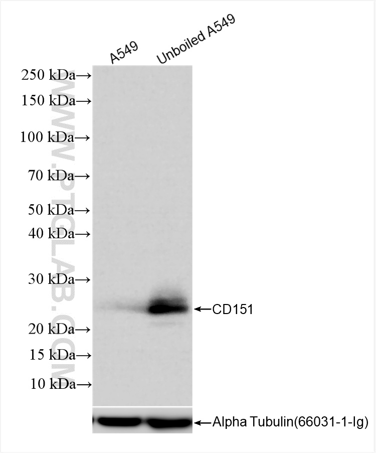 WB analysis using 85385-1-RR (same clone as 85385-1-PBS)