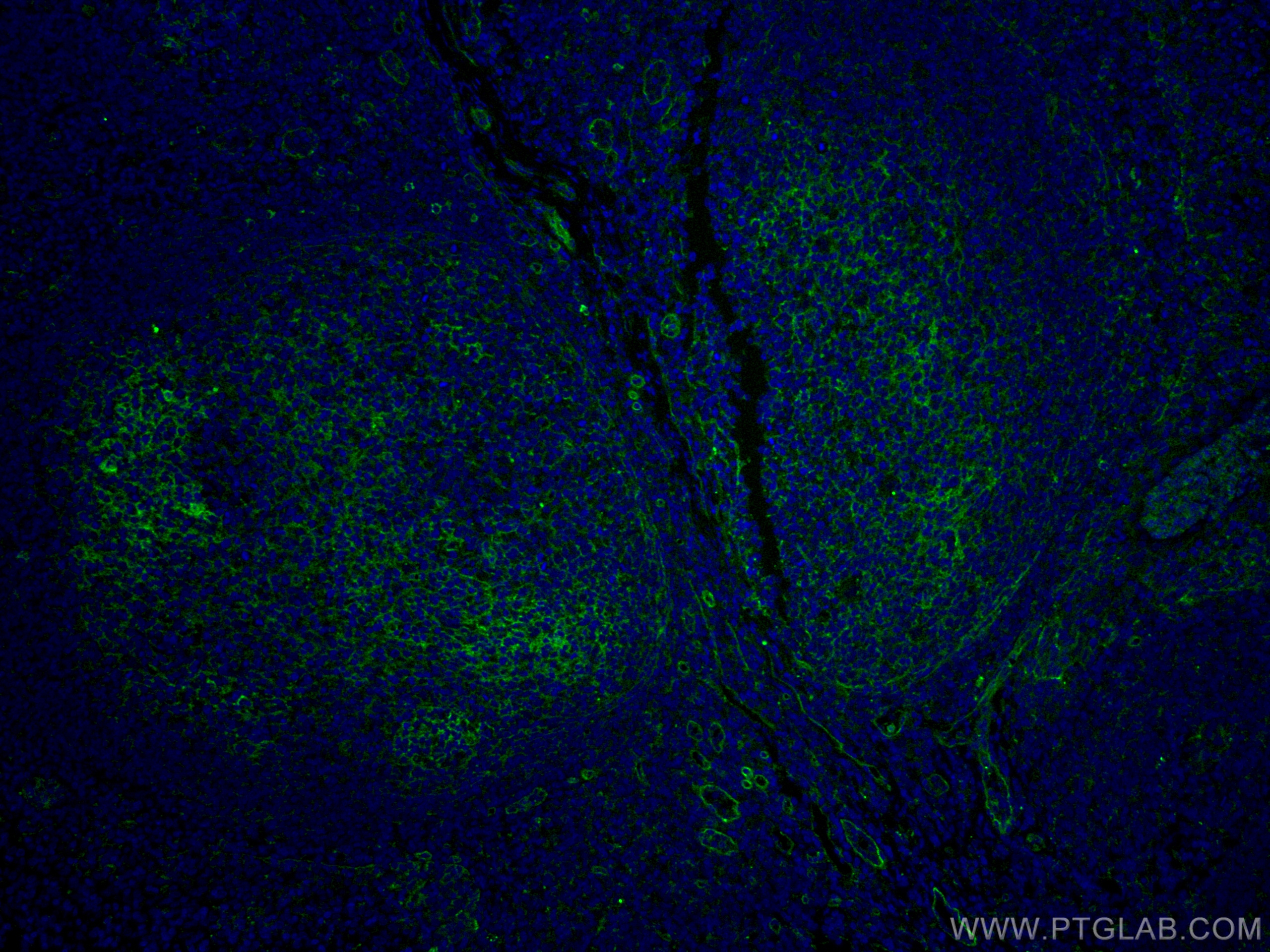 IF Staining of human tonsillitis using CL488-66567