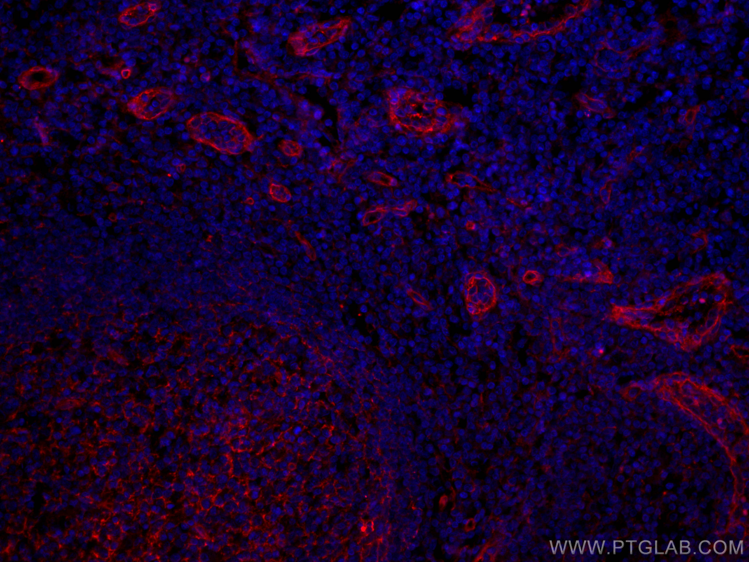 IF Staining of human tonsillitis using CL594-66567