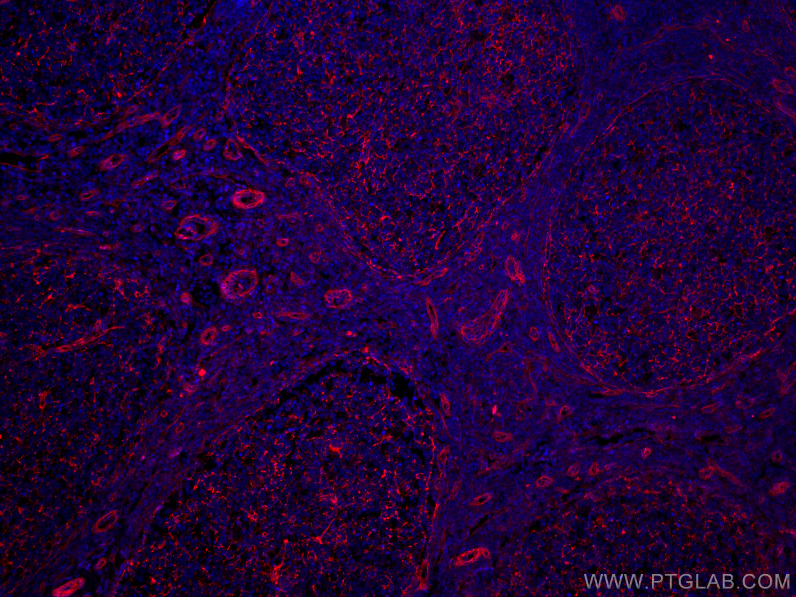 IF Staining of human tonsillitis using CL594-66567