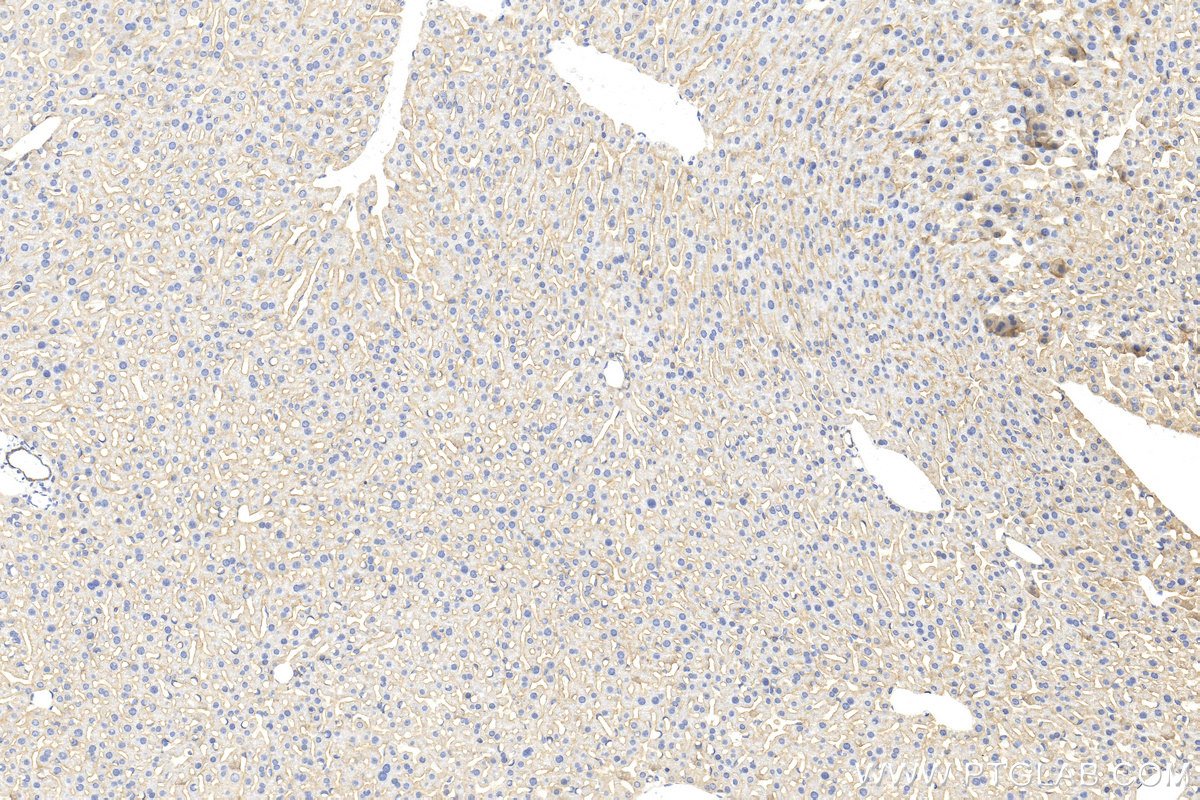 IHC staining of mouse liver using 31447-1-AP
