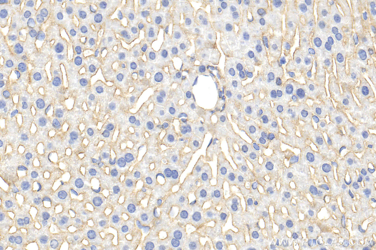 IHC staining of mouse liver using 31447-1-AP