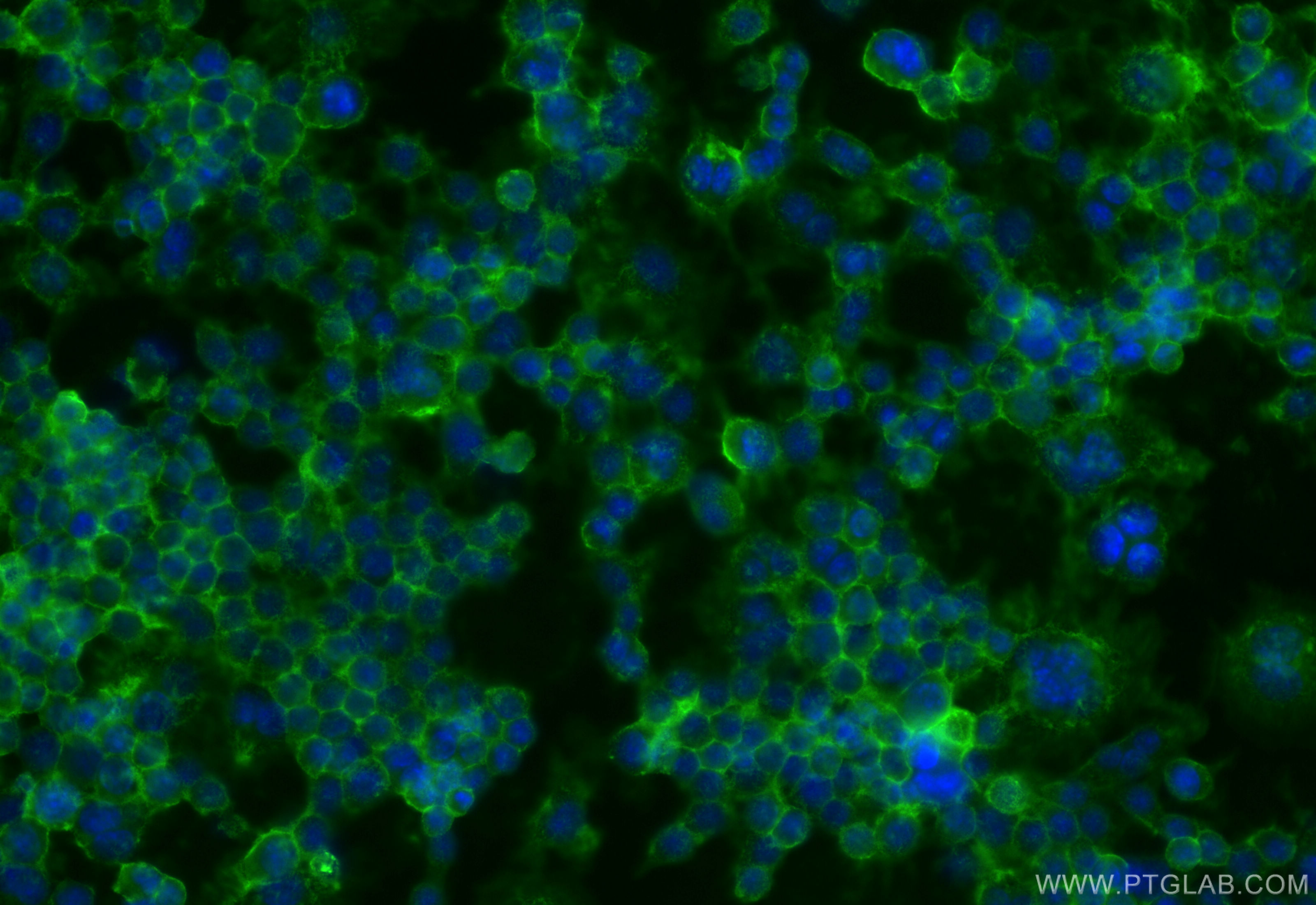 IF Staining of RAW 264.7 using 83724-6-RR (same clone as 83724-6-PBS)