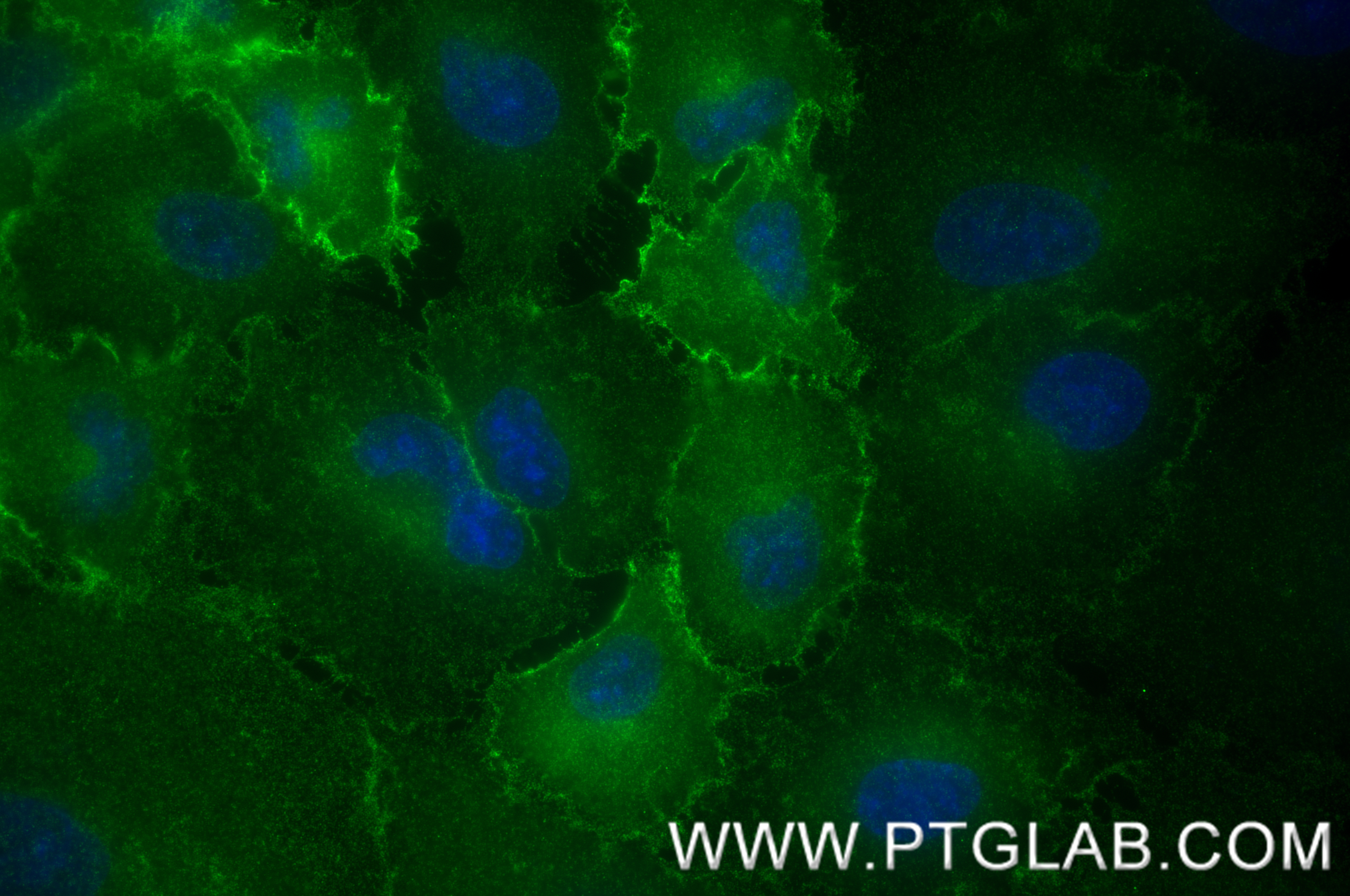 IF Staining of A549 using 84138-5-RR (same clone as 84138-5-PBS)