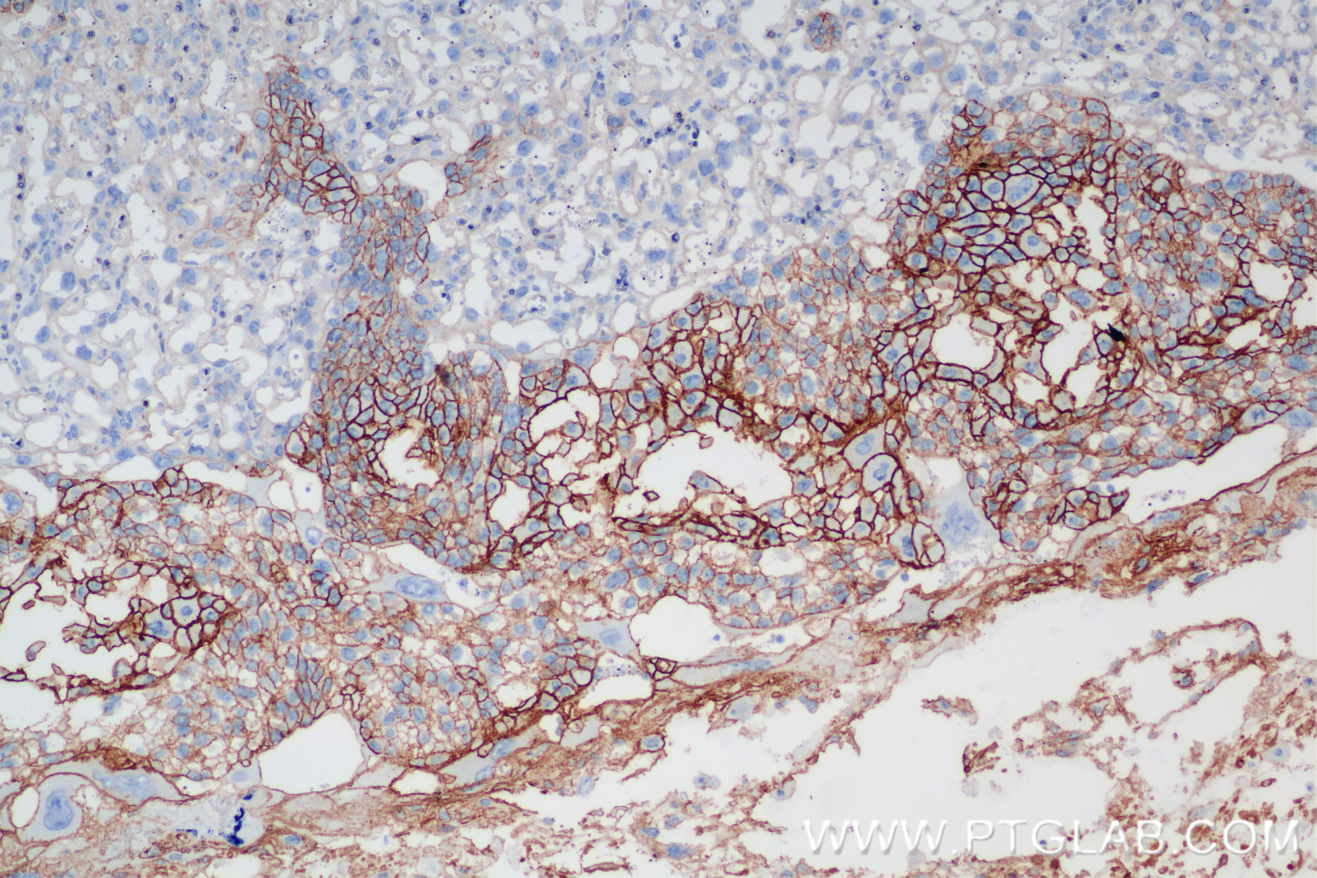 IHC staining of mouse placenta using 85006-1-RR