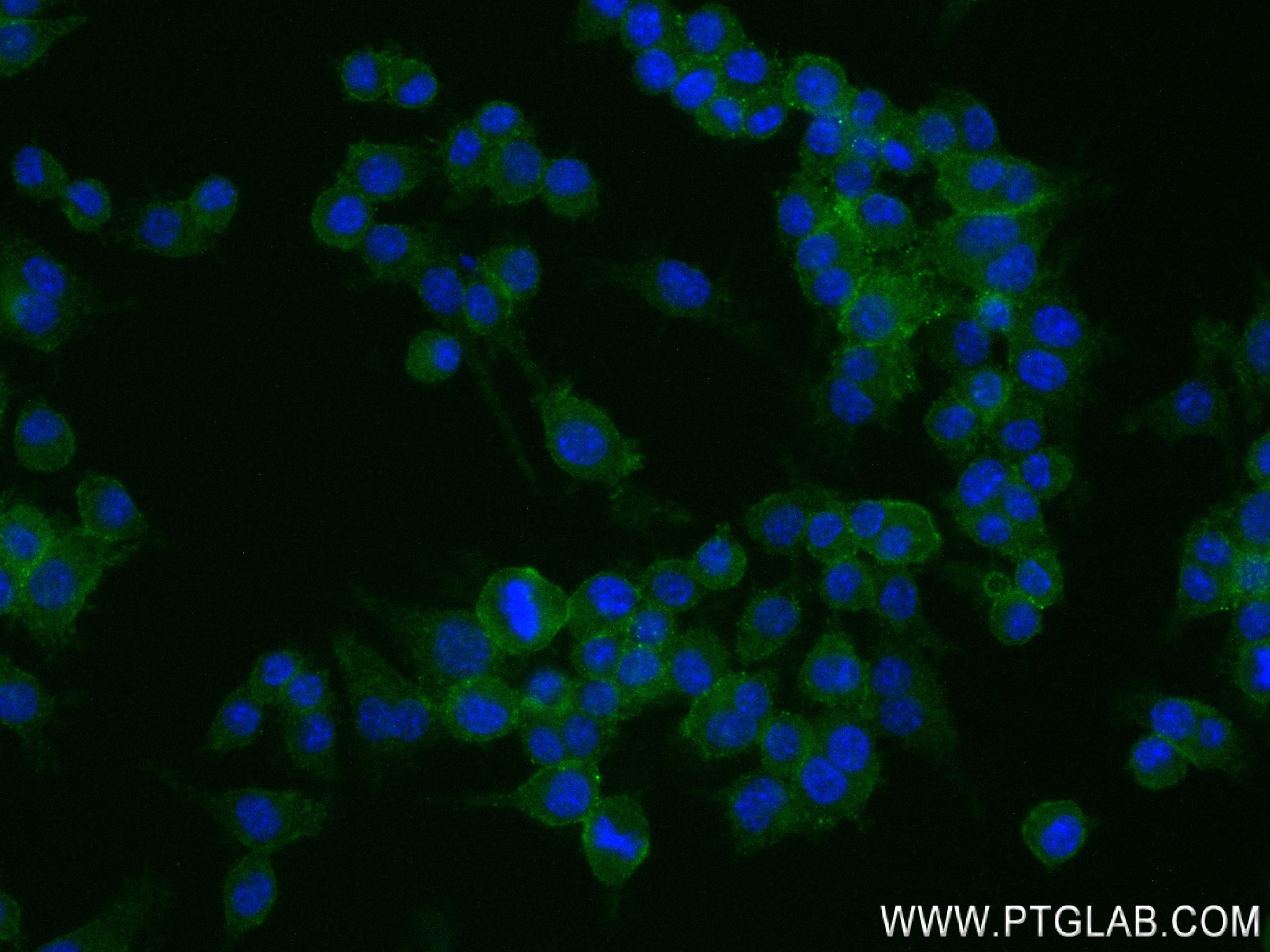 IF Staining of RAW 264.7 using 84417-5-RR