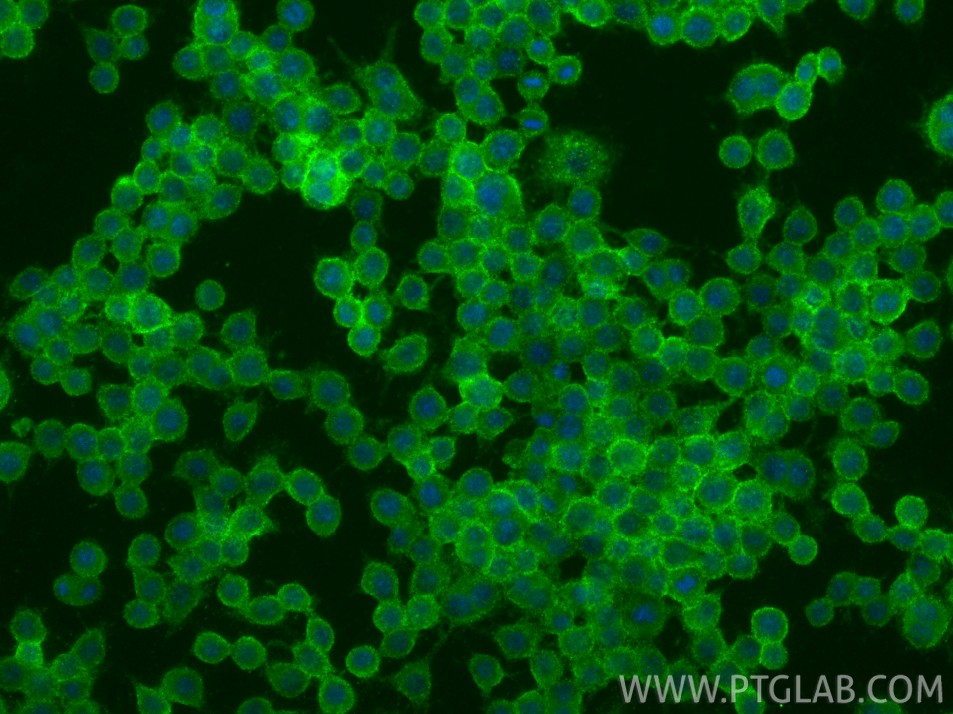 IF Staining of RAW 264.7 using 84417-5-RR IF Staining of RAW 264.7 using 84417-5-RR