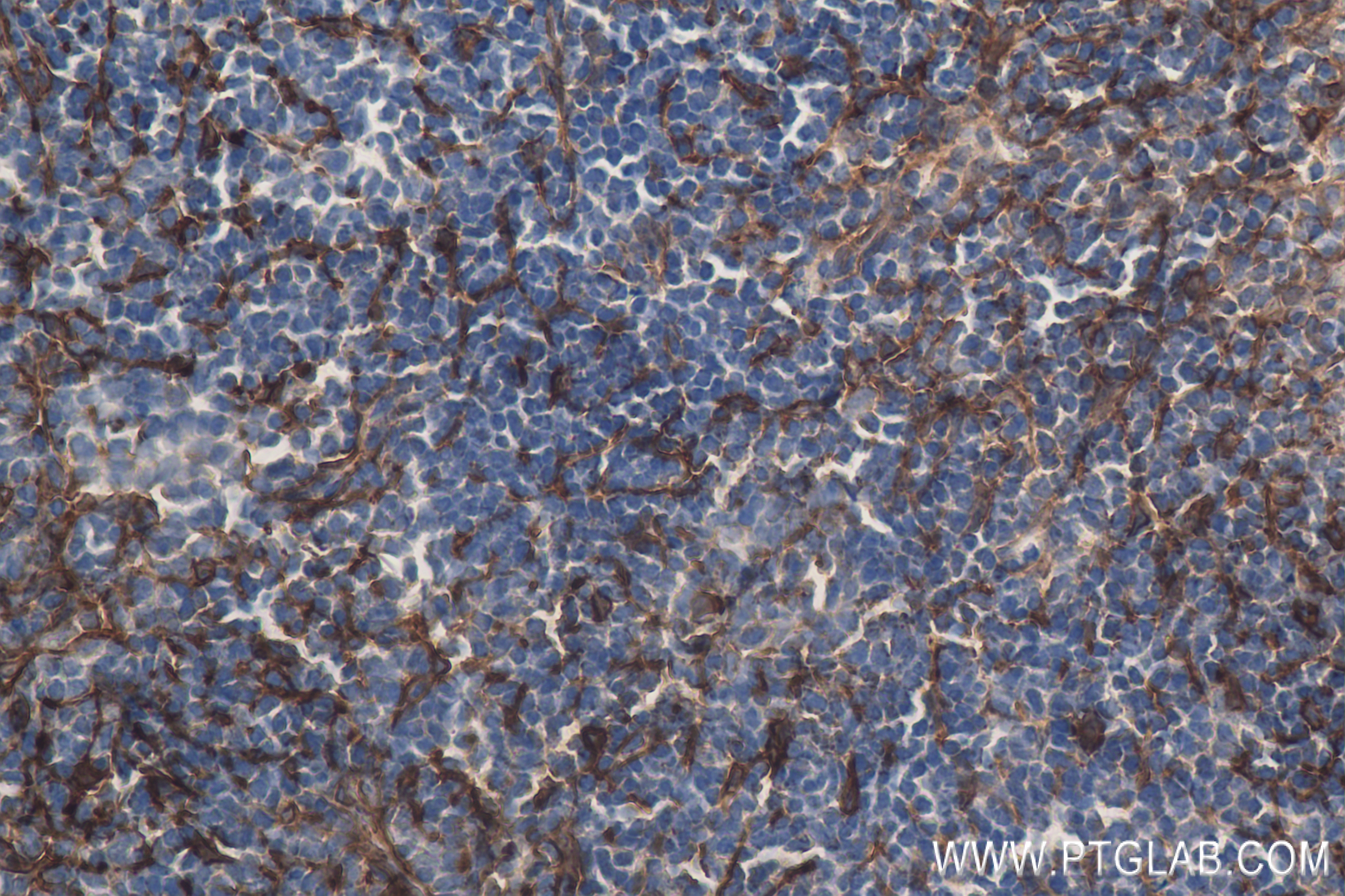 IHC staining of mouse spleen using 84417-5-RR
