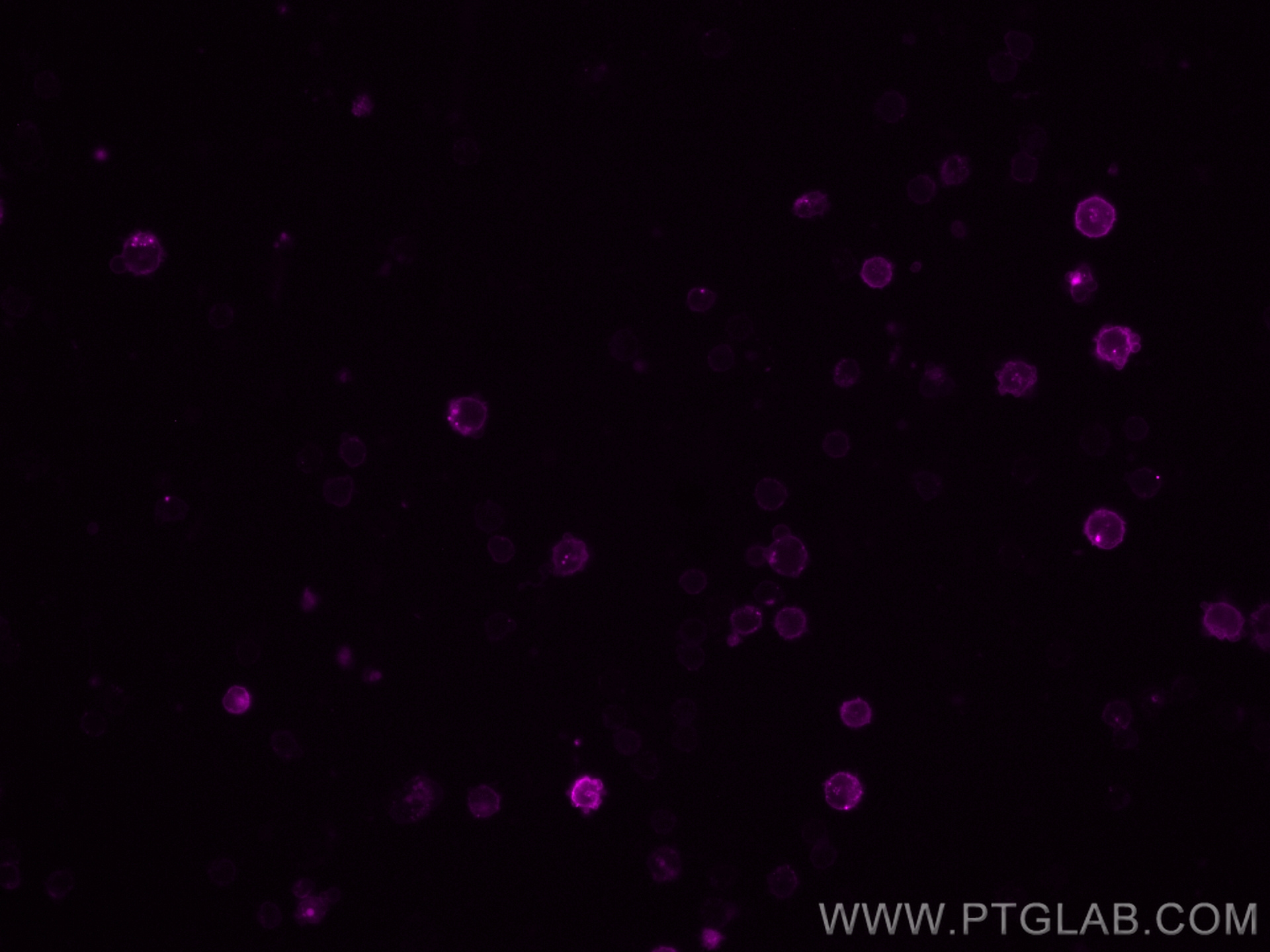 IF Staining of mouse splenocytes using CL647-65057