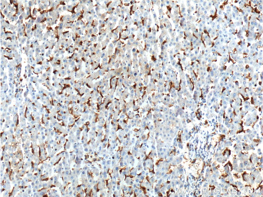 IHC staining of human liver using 16559-1-AP