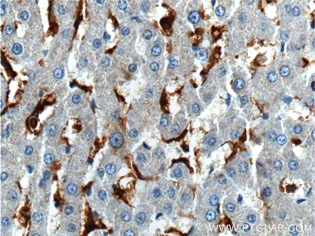 IHC staining of human liver using 16559-1-AP