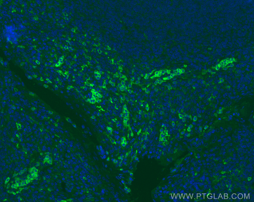 IF Staining of human tonsillitis using 66779-1-Ig (same clone as 66779-1-PBS)