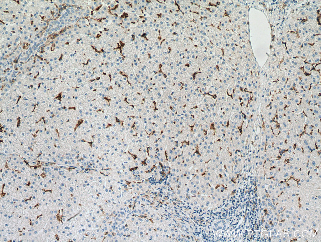 IHC staining of human liver using 66779-1-Ig (same clone as 66779-1-PBS)