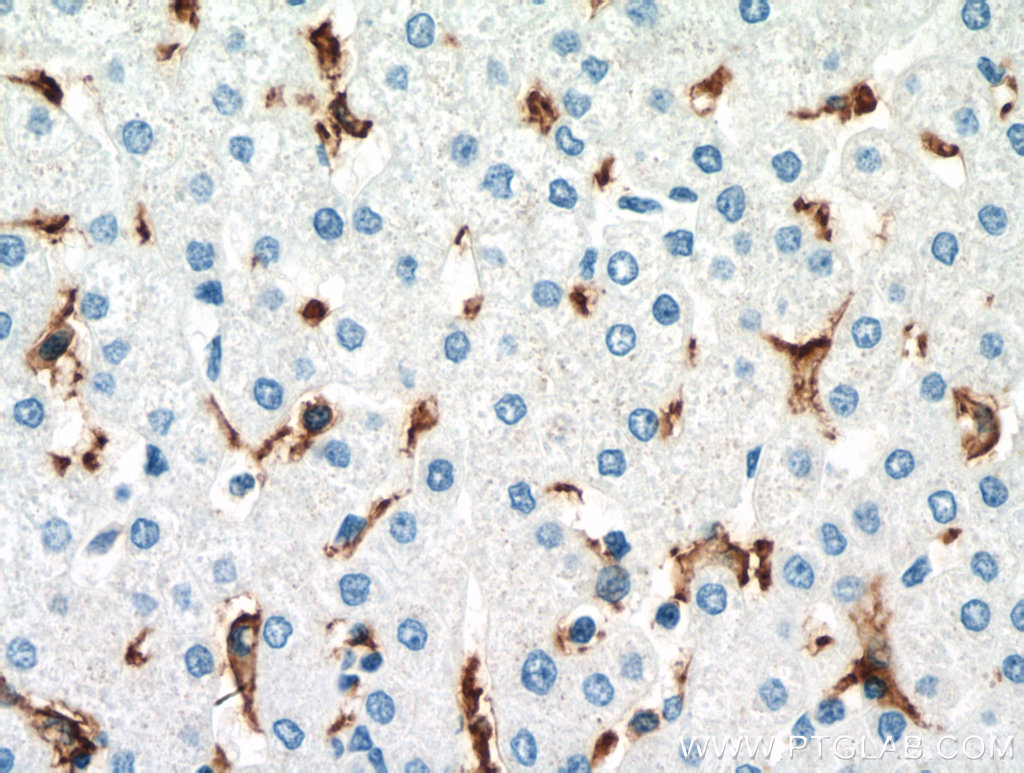 IHC staining of human liver using 66779-1-Ig