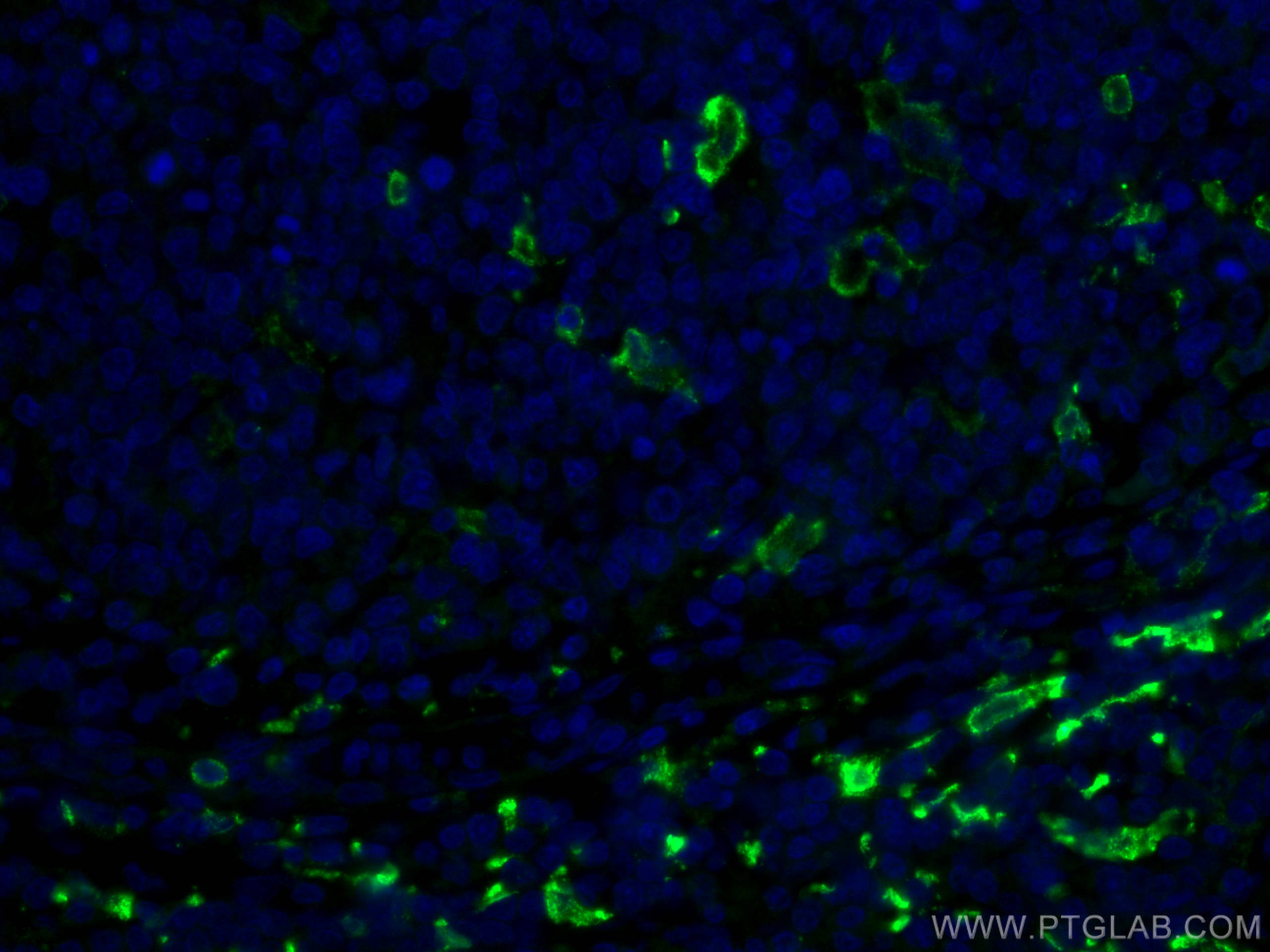 IF Staining of human tonsillitis using 16646-1-AP