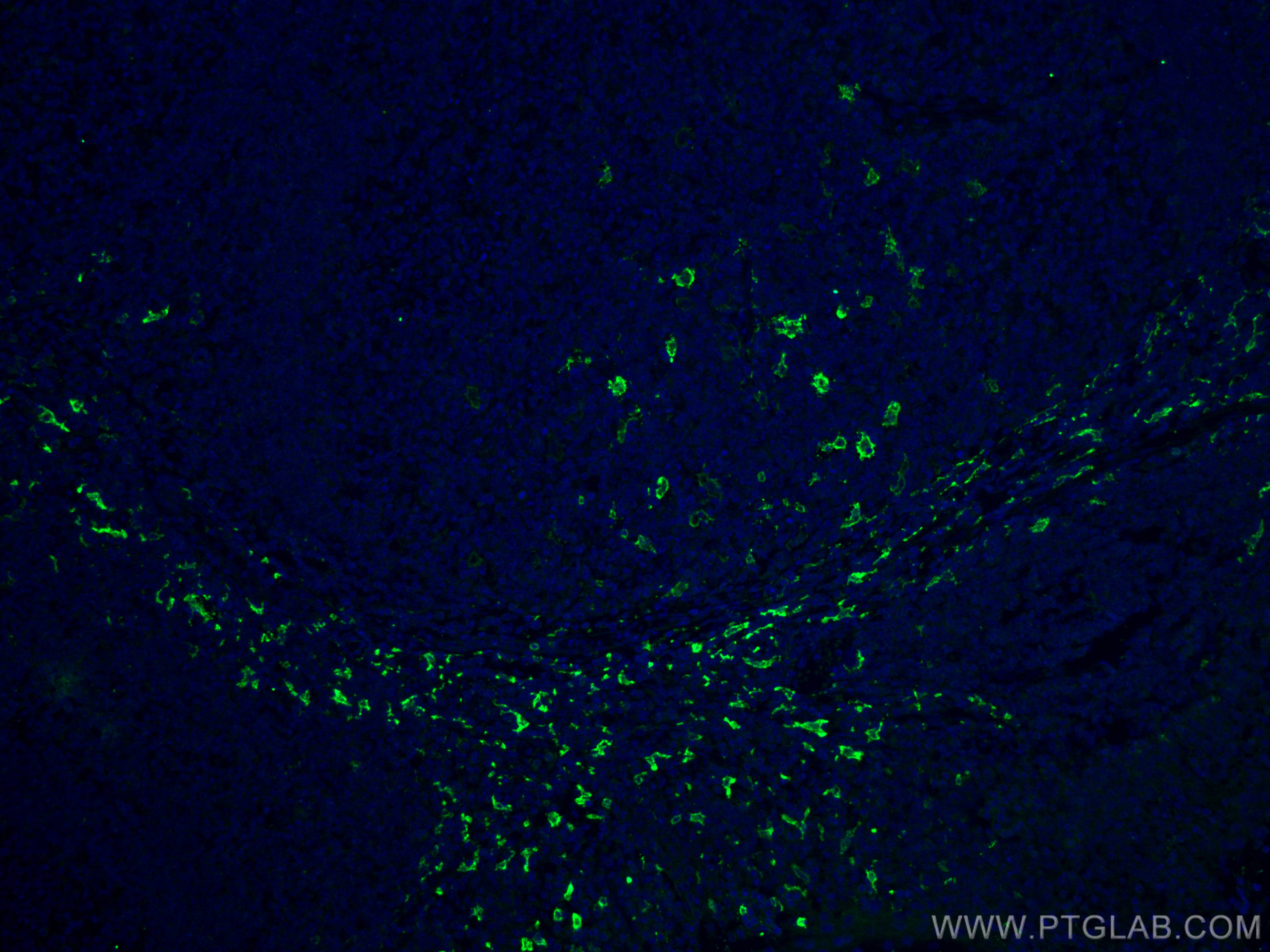 IF Staining of human tonsillitis using 16646-1-AP