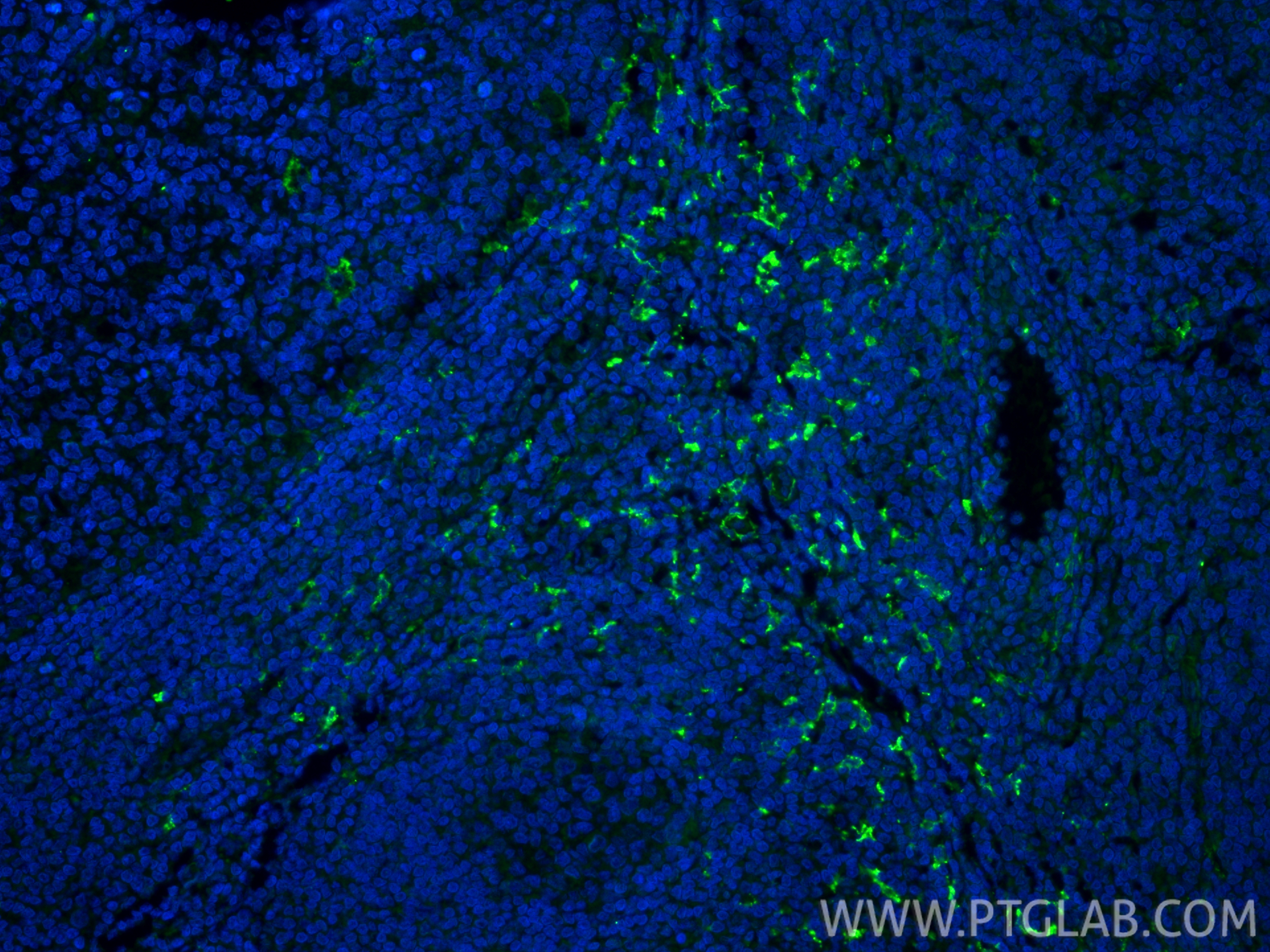 Immunofluorescent analysis of (4% PFA) fixed paraffin-embedded human tonsillitis tissue using CD163 antibody (16646-1-AP) at dilution of 1:400 and CoraLite®488-Conjugated Goat Anti-Rabbit IgG(H+L) (<a class='green' href='/productredirect?CatalogNo=SA00013-2' target='_blank'>SA00013-2</a>). Heat mediated antigen retrieval with Tris-EDTA buffer (pH 9.0). IF Staining of human tonsillitis using 16646-1-AP