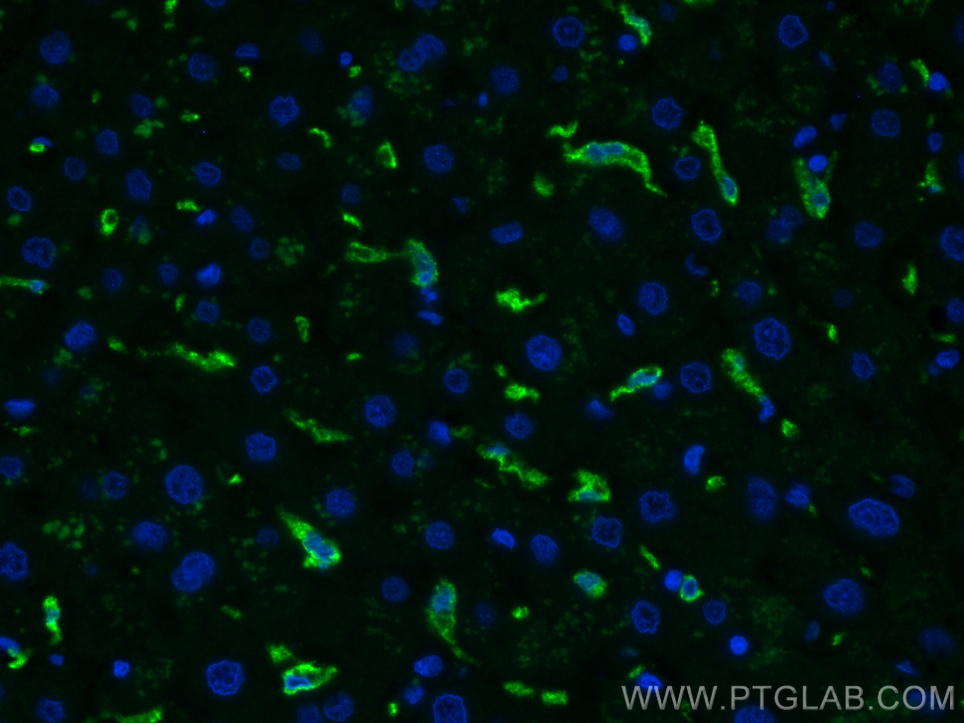 IF Staining of human liver using 68218-1-Ig
