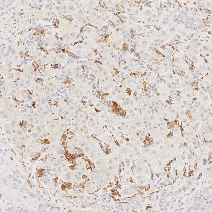 IHC staining of human liver using 68218-1-Ig IHC staining of human liver using 68218-1-Ig