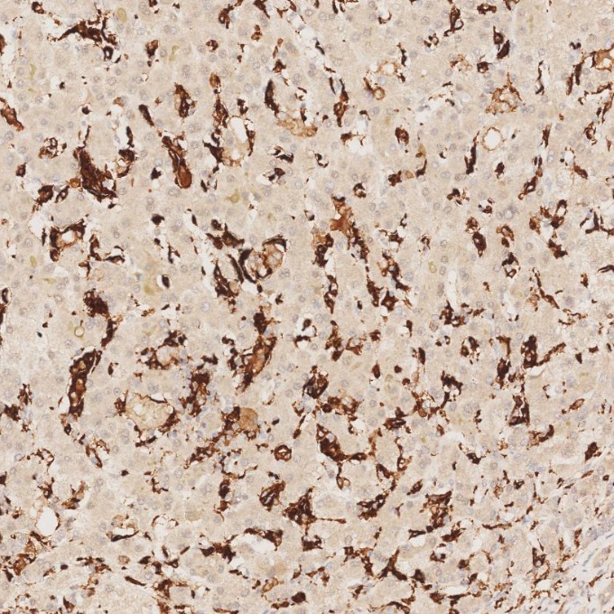 IHC staining of human liver using 68218-1-Ig IHC staining of human liver using 68218-1-Ig