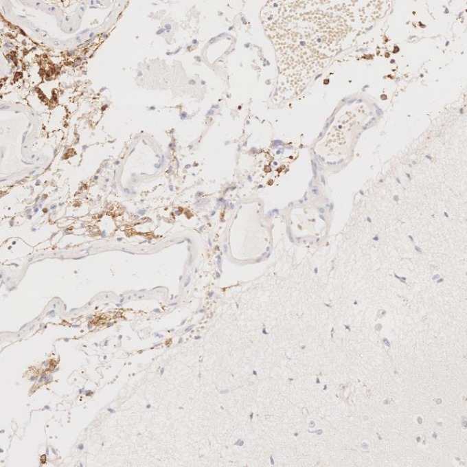 IHC staining of human brain using 68218-1-Ig IHC staining of human brain using 68218-1-Ig