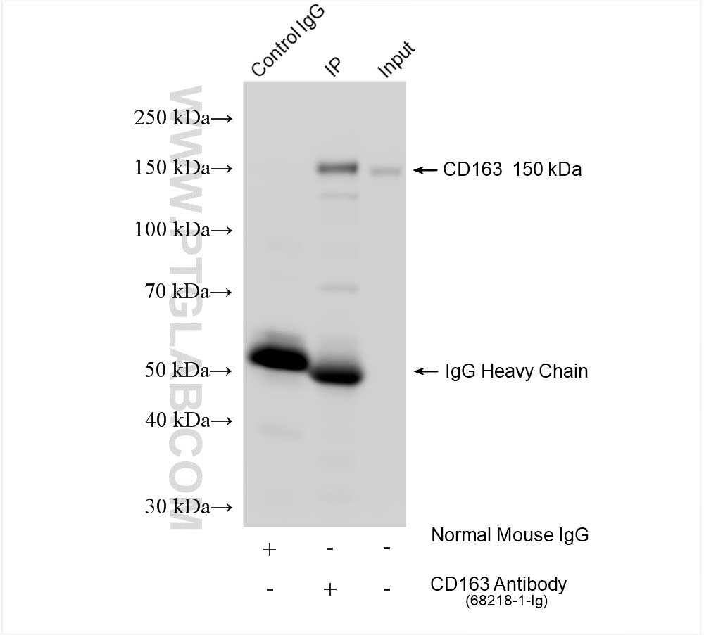 IP experiment of human placenta using 68218-1-Ig