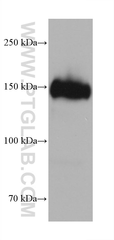 WB analysis of human placenta using 68218-1-Ig