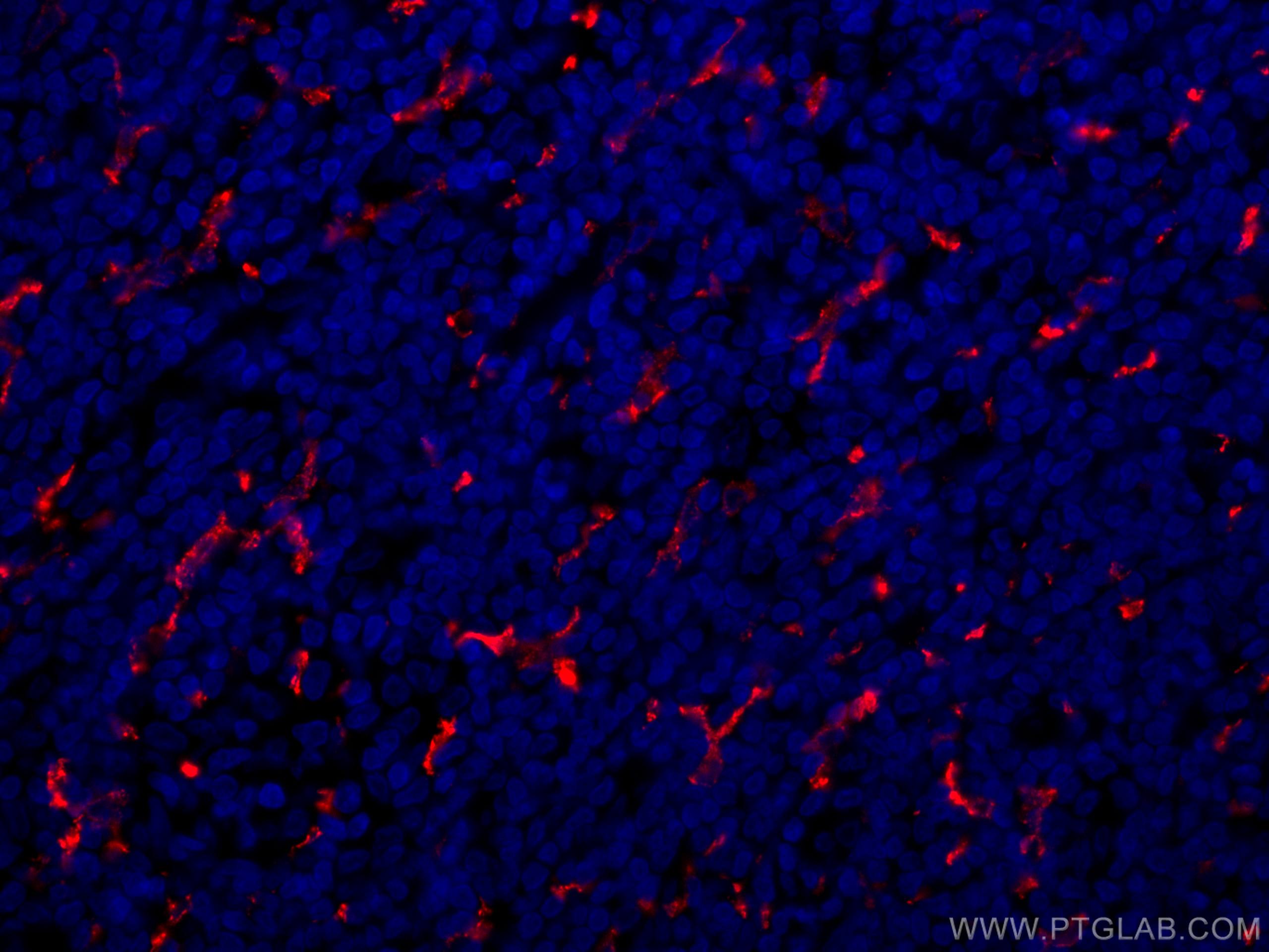 IF Staining of human tonsillitis using CL594-16646