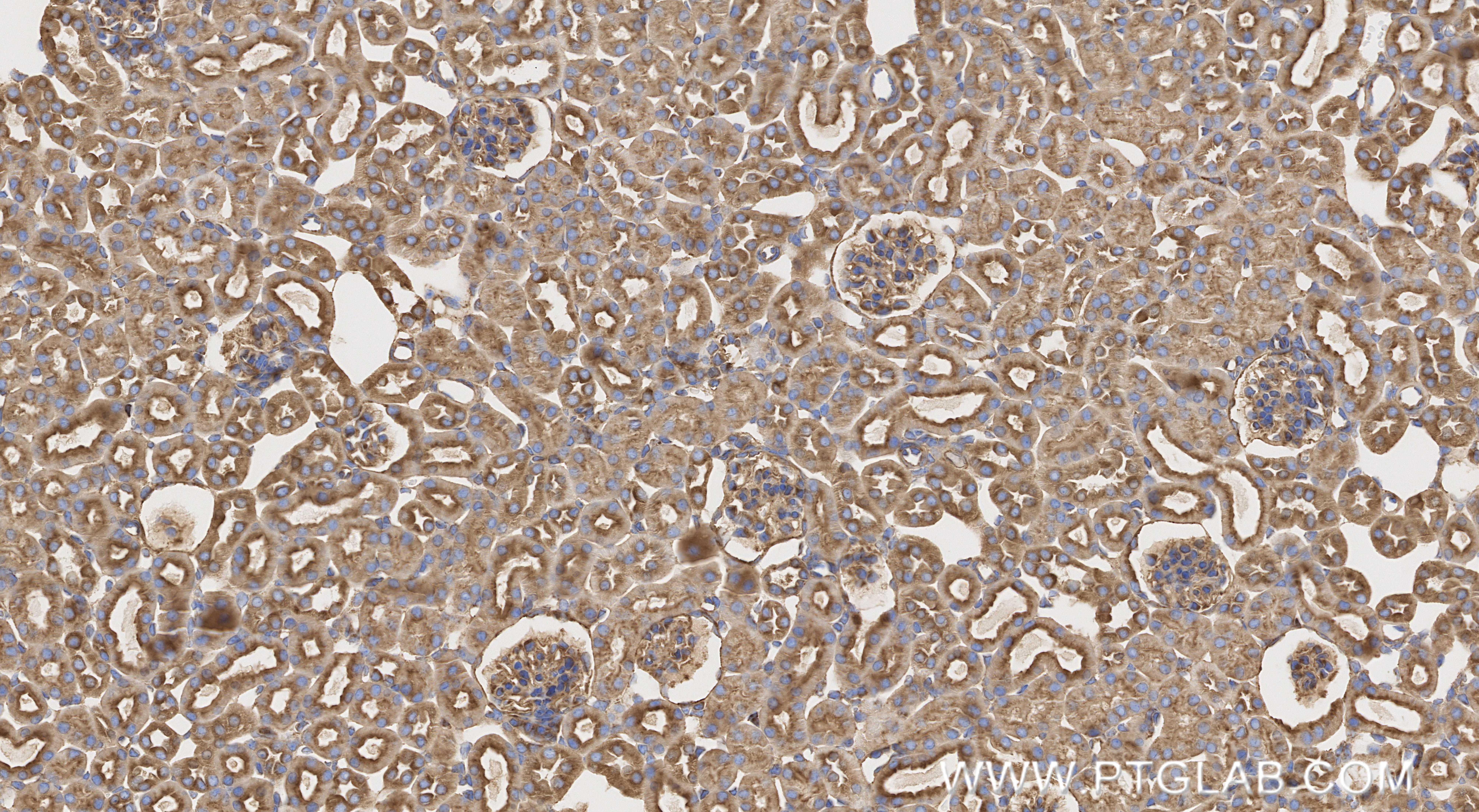 IHC staining of mouse kidney using 85723-4-RR