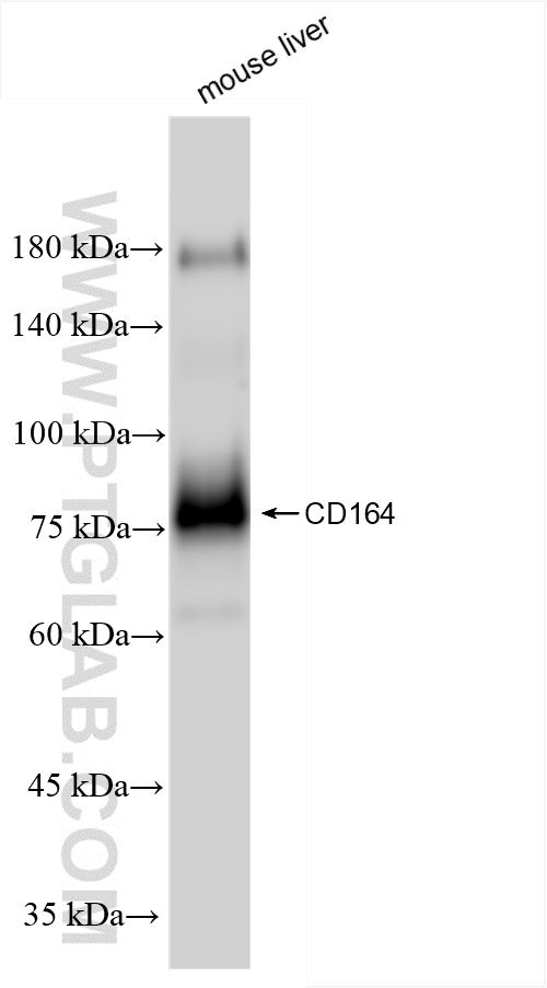 WB analysis of mouse liver using 85723-4-RR