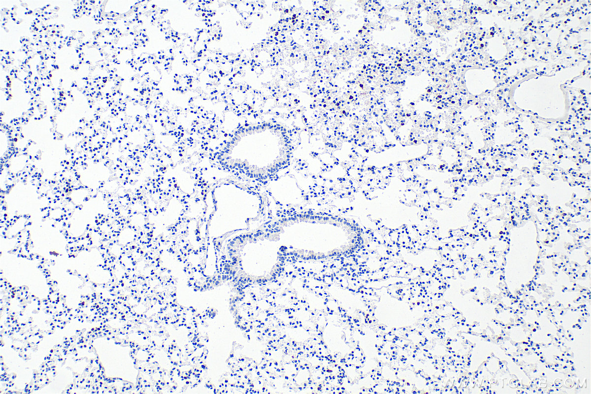 IHC staining of mouse lung using 33733-1-AP