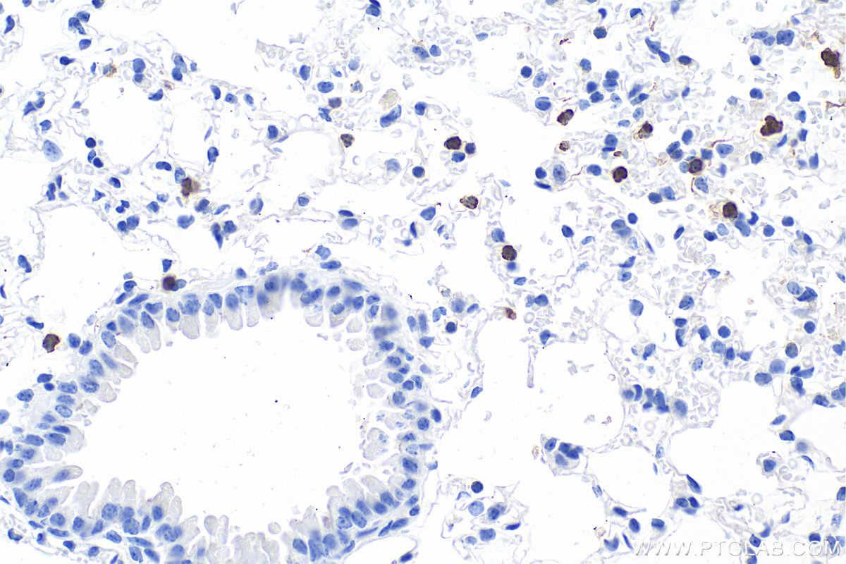 IHC staining of mouse lung using 33733-1-AP