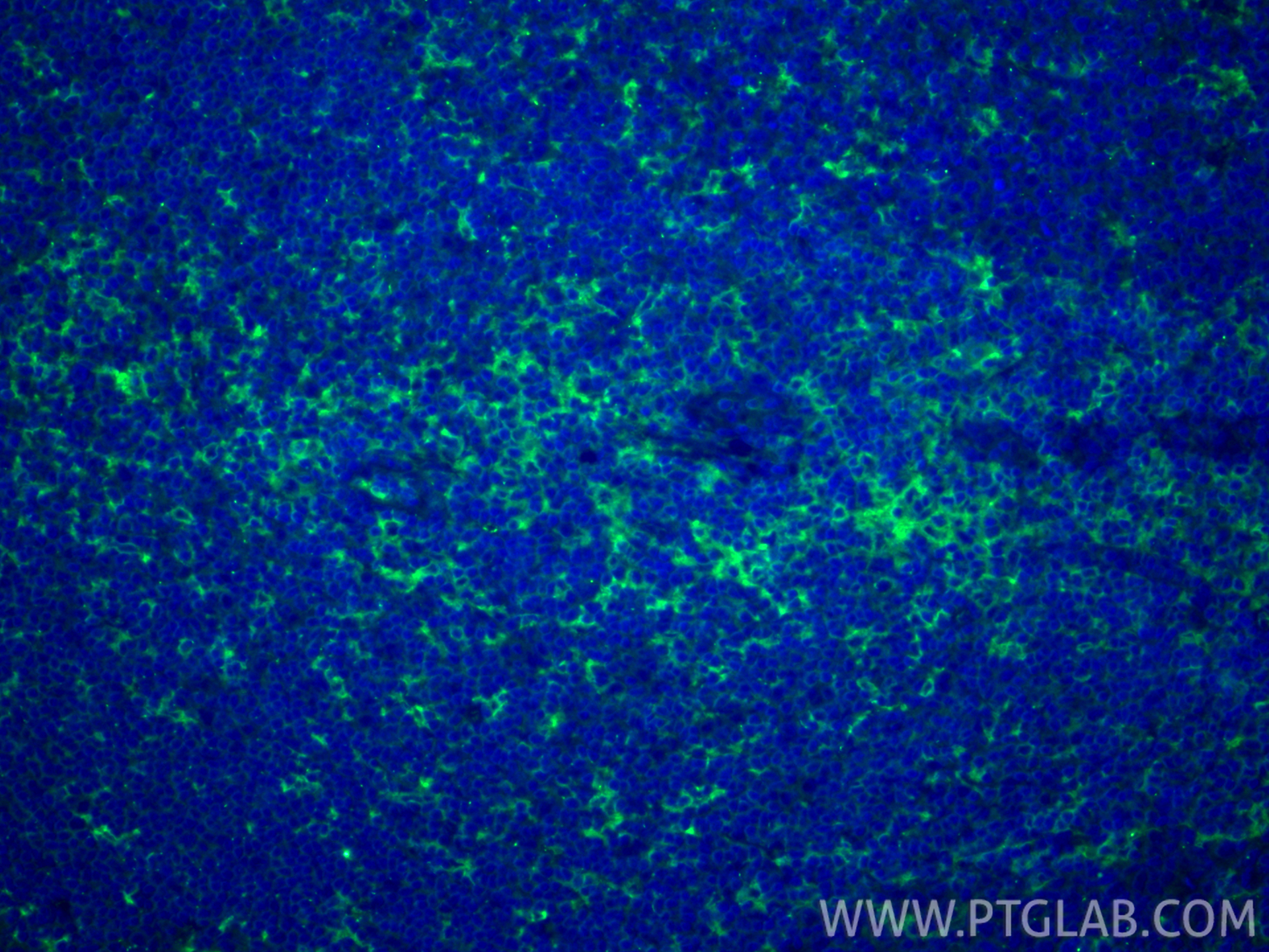 Immunofluorescent analysis of (4% PFA) fixed paraffin-embedded human tonsillitis tissue using CD18 antibody (10554-1-AP) at dilution of 1:200 and CoraLite®488-Conjugated Goat Anti-Rabbit IgG(H+L) (<a class='green' href='/productredirect?CatalogNo=SA00013-2' target='_blank'>SA00013-2</a>). Heat mediated antigen retrieval with Tris-EDTA buffer (pH 9.0). IF Staining of human tonsillitis using 10554-1-AP