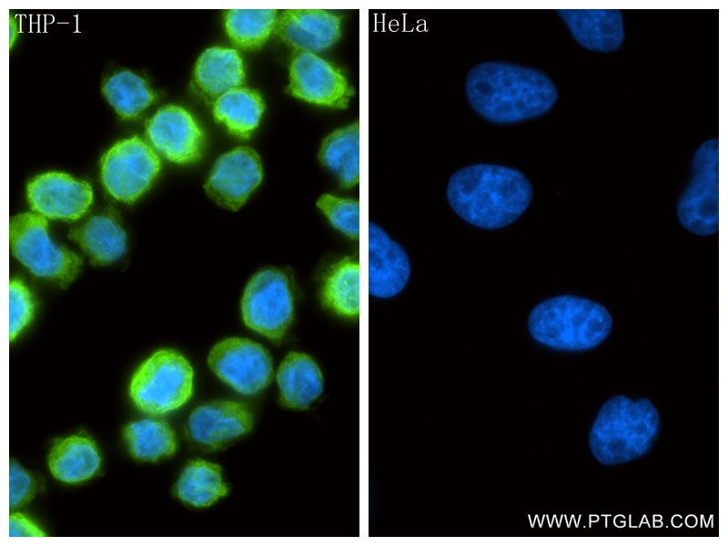 IF Staining of THP-1 using 87449-1-RR IF Staining of THP-1 using 87449-1-RR