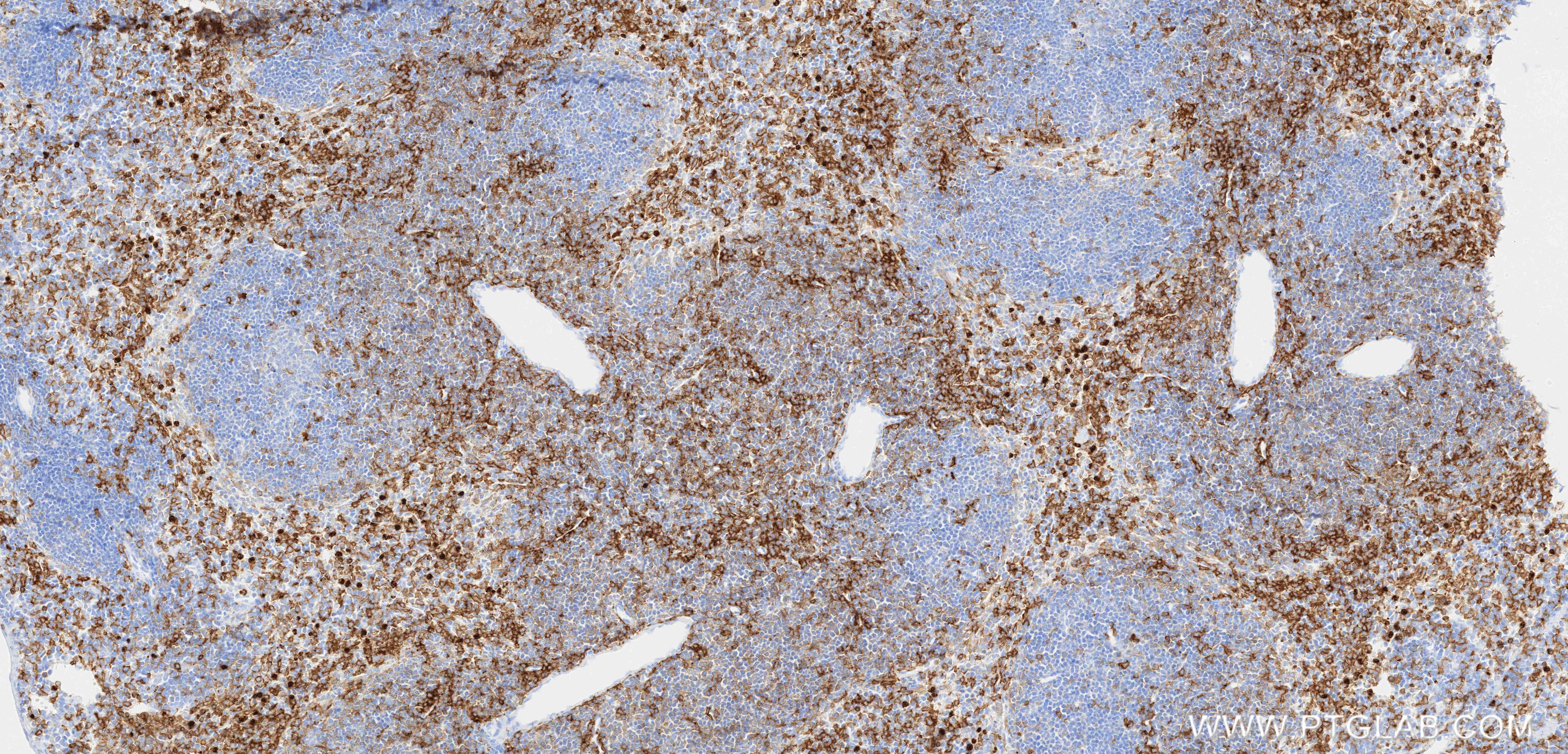 IHC staining of mouse spleen using 87481-2-RR (same clone as 87481-2-PBS) IHC staining of mouse spleen using 87481-2-RR (same clone as 87481-2-PBS)