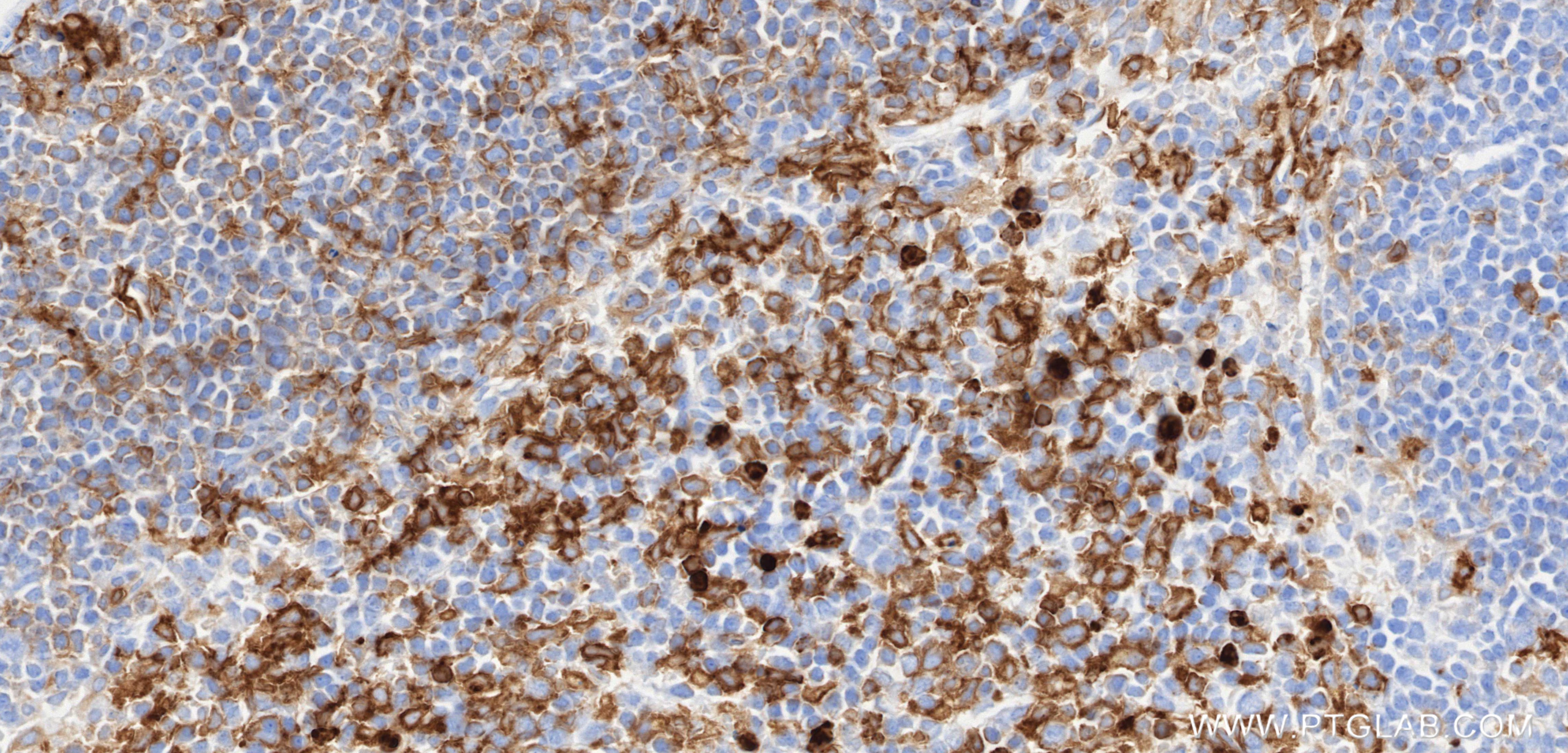 IHC staining of mouse spleen using 87481-2-RR (same clone as 87481-2-PBS) IHC staining of mouse spleen using 87481-2-RR (same clone as 87481-2-PBS)