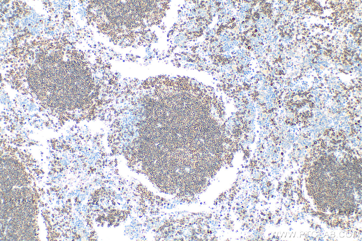 IHC staining of mouse spleen using 31263-1-AP